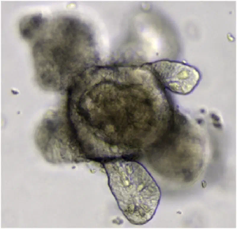 intestinal organoid