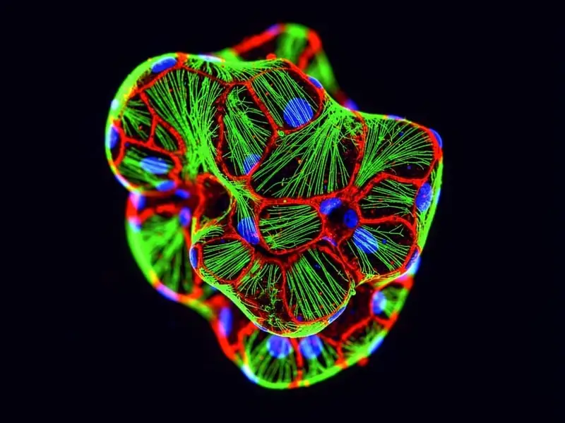 cardiac organoid